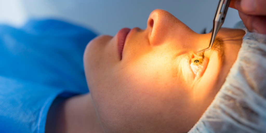 What Line Items Make Up Eye Laser Surgery Cost Quotes
